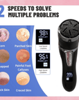 FootBliss Ultra demonstrating its two-speed settings for tailored foot care.